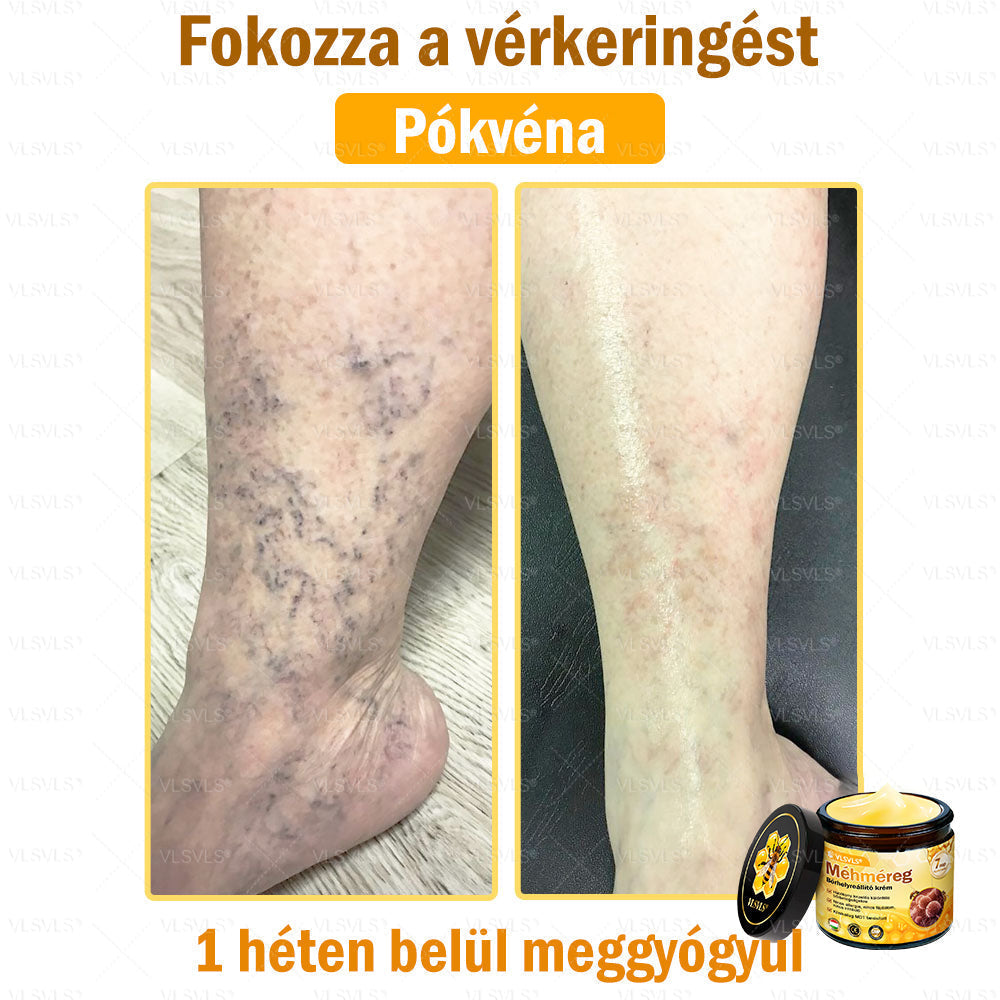 VLSVLS® Méhméreg Bőrhelyreállító Krém (👨⚕CE jóváhagyott)💎