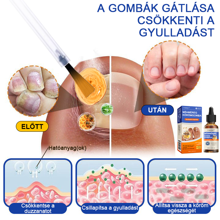 🐝Furzero™ Méhméreg Körömgomba Kezelőoldat: Teljes megoldás a körömgomba problémájára🌟