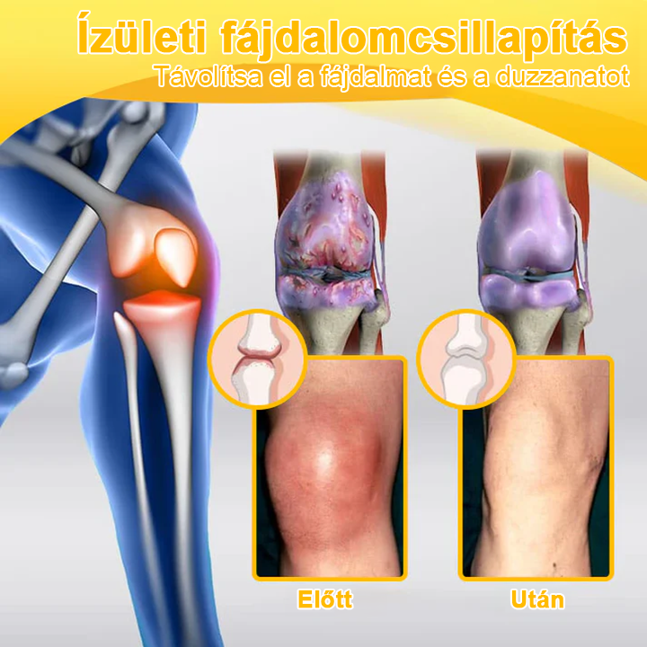 🌟TLOPA® Botulinum Toxin és Méhméreg Fájdalomcsillapító Csontgyógyító Krém🐝 🔥(Kifejezetten időseknek & ortopéd szakorvosok ajánlásával)🦴