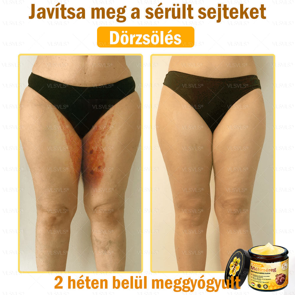 VLSVLS® Méhméreg Bőrhelyreállító Krém (👨⚕CE jóváhagyott)💎