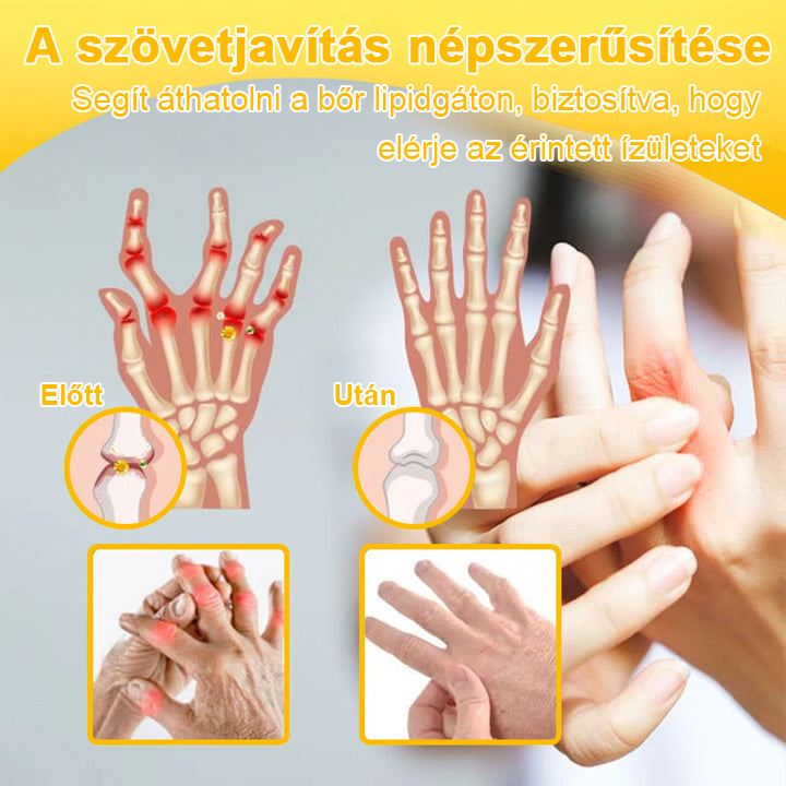 🌟TLOPA® Botulinum Toxin és Méhméreg Fájdalomcsillapító Csontgyógyító Krém🐝 🔥(Kifejezetten időseknek & ortopéd szakorvosok ajánlásával)🦴