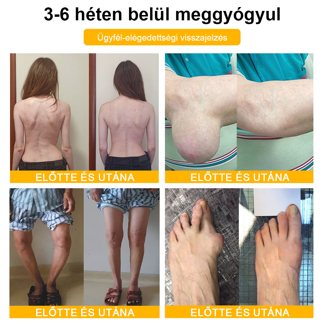 🌟TLOPA® Botulinum Toxin és Méhméreg Fájdalomcsillapító Csontgyógyító Krém🐝 🔥(Kifejezetten időseknek & ortopéd szakorvosok ajánlásával)🦴