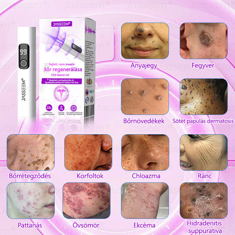 💎𝐉𝐚𝐬𝐬𝐞𝐞𝐦® Zaawansowany nieinwazyjny laser CO₂ do naprawy skóry 🎉 (Delikatnie usuwa brodawki, znamiona, plamy starcze i narośla skórne – bez bólu, bez zamieszania!)🚀