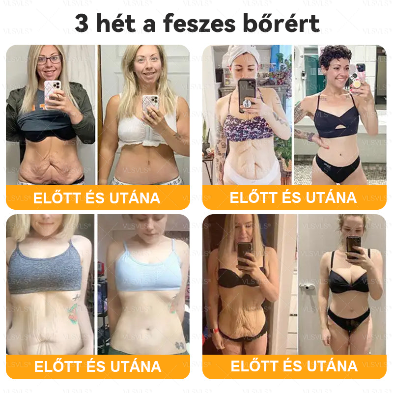 🌿 VLSVLS® Méhméreg Bőrhelyreállító Krém 🔥 UTOLSÓ NAP – 80% KEDVEZMÉNY 🎁