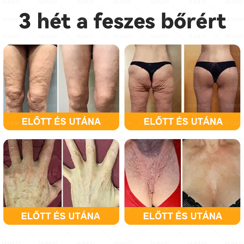 🌿 VLSVLS® Méhméreg Bőrhelyreállító Krém 🔥 UTOLSÓ NAP – 80% KEDVEZMÉNY 🎁