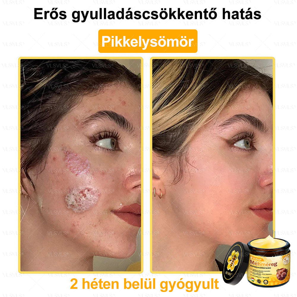 VLSVLS® Méhméreg Bőrhelyreállító Krém (👨⚕CE jóváhagyott)💎