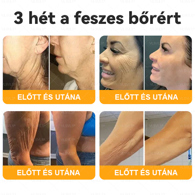 🌿 VLSVLS® Méhméreg Bőrhelyreállító Krém 🔥 UTOLSÓ NAP – 80% KEDVEZMÉNY 🎁