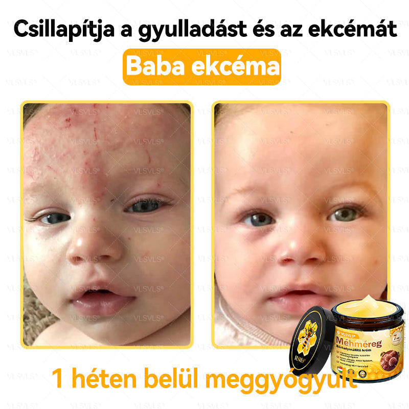 VLSVLS® Méhméreg Bőrhelyreállító Krém (👨⚕CE jóváhagyott)💎