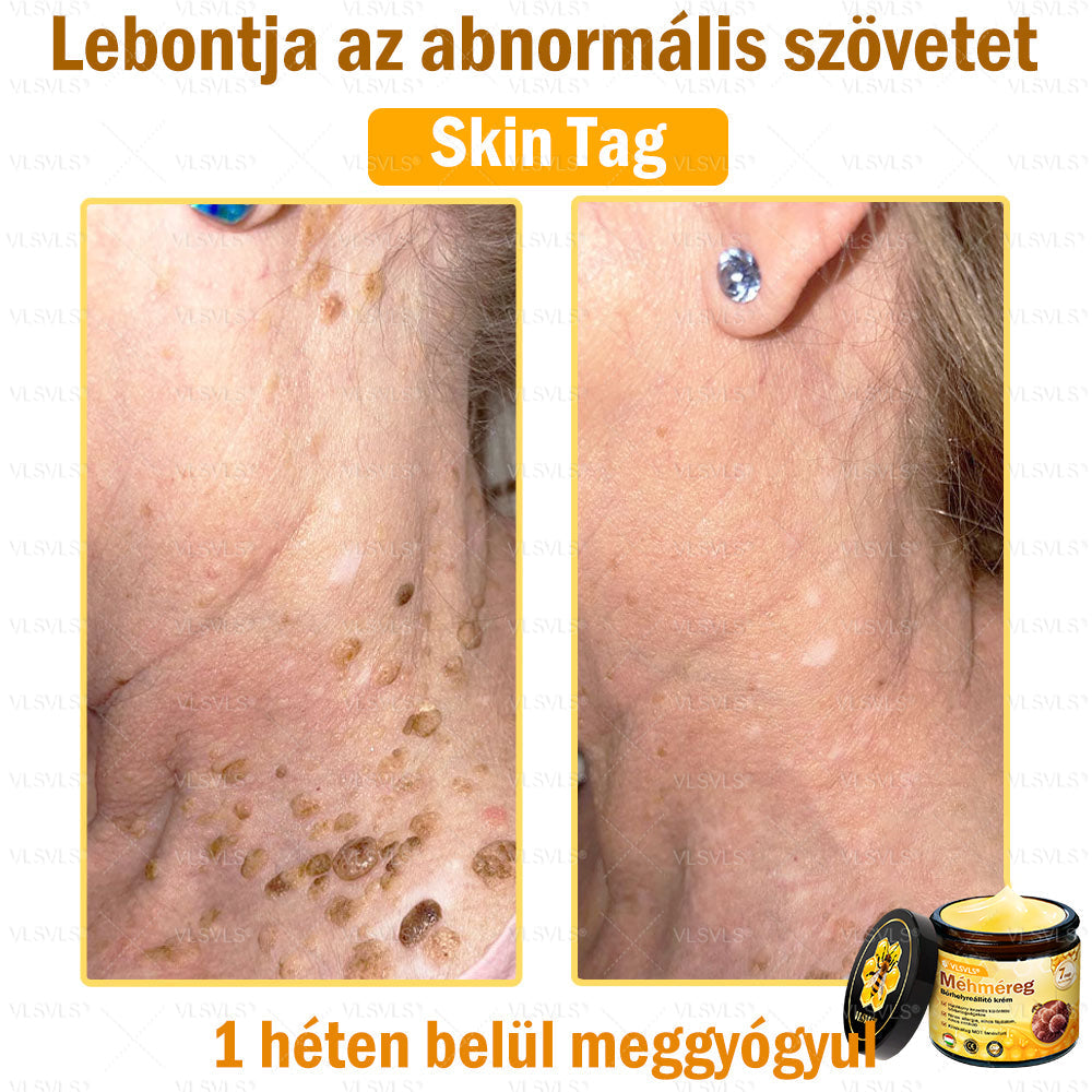 VLSVLS® Méhméreg Bőrhelyreállító Krém (👨⚕CE jóváhagyott)💎