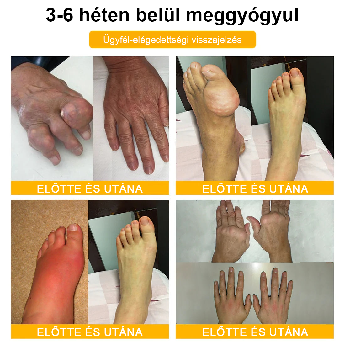 🌟TLOPA® Botulinum Toxin és Méhméreg Fájdalomcsillapító Csontgyógyító Krém🐝 🔥(Kifejezetten időseknek & ortopéd szakorvosok ajánlásával)🦴