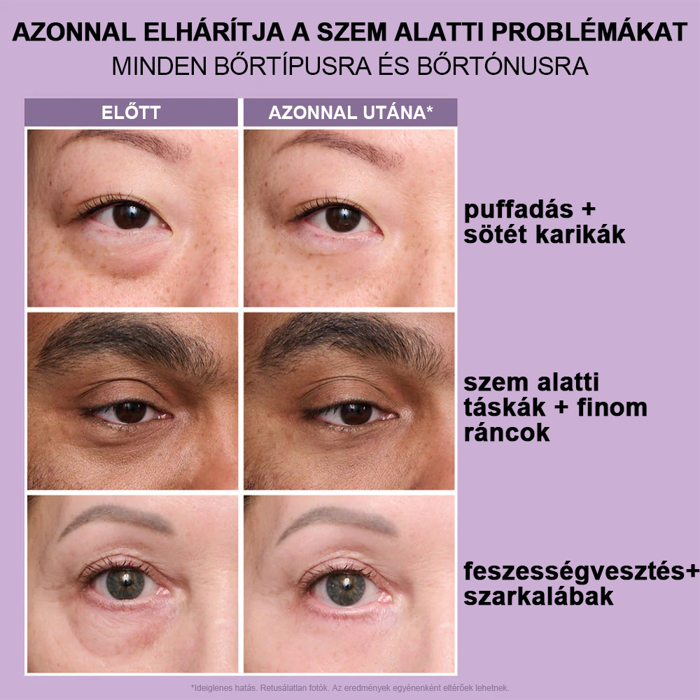 💎Azonnali Szemkörnyék-feszesítő, könnyen viselhető formula🌸 – tökéletes emelés és sima felület ✨