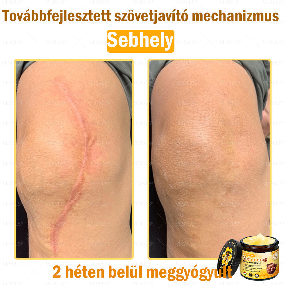 VLSVLS® Méhméreg Bőrhelyreállító Krém (👨⚕CE jóváhagyott)💎
