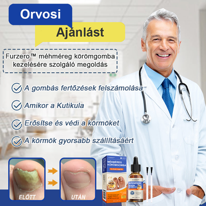 🐝Furzero™ Méhméreg Körömgomba Kezelőoldat: Teljes megoldás a körömgomba problémájára🌟