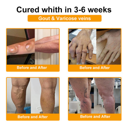 🌟TLOPA® Botulinum Toxin és Méhméreg Fájdalomcsillapító Csontgyógyító Krém🐝 🔥(Kifejezetten időseknek & ortopéd szakorvosok ajánlásával)🦴