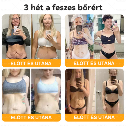 🌿 VLSVLS® Méhméreg Bőrhelyreállító Krém 🔥 UTOLSÓ NAP – 80% KEDVEZMÉNY 💎