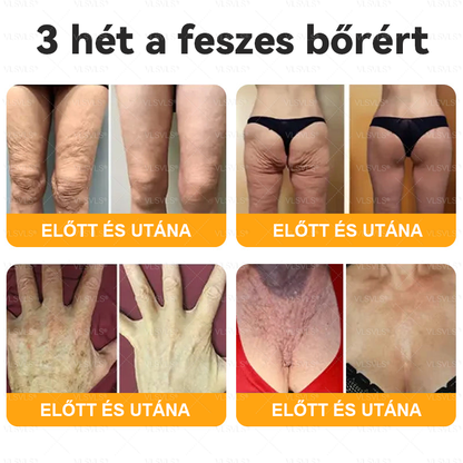 🌿 VLSVLS® Méhméreg Bőrhelyreállító Krém 🔥 UTOLSÓ NAP – 80% KEDVEZMÉNY 💎