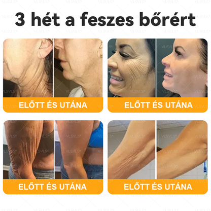 🌿 VLSVLS® Méhméreg Bőrhelyreállító Krém 🔥 UTOLSÓ NAP – 80% KEDVEZMÉNY 💎