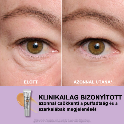 🌟Azonnali Szemkörnyék-feszesítő, könnyen viselhető formula🌸 – tökéletes emelés és sima felület ✨