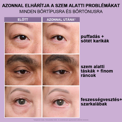 🌟Azonnali Szemkörnyék-feszesítő, könnyen viselhető formula🌸 – tökéletes emelés és sima felület ✨