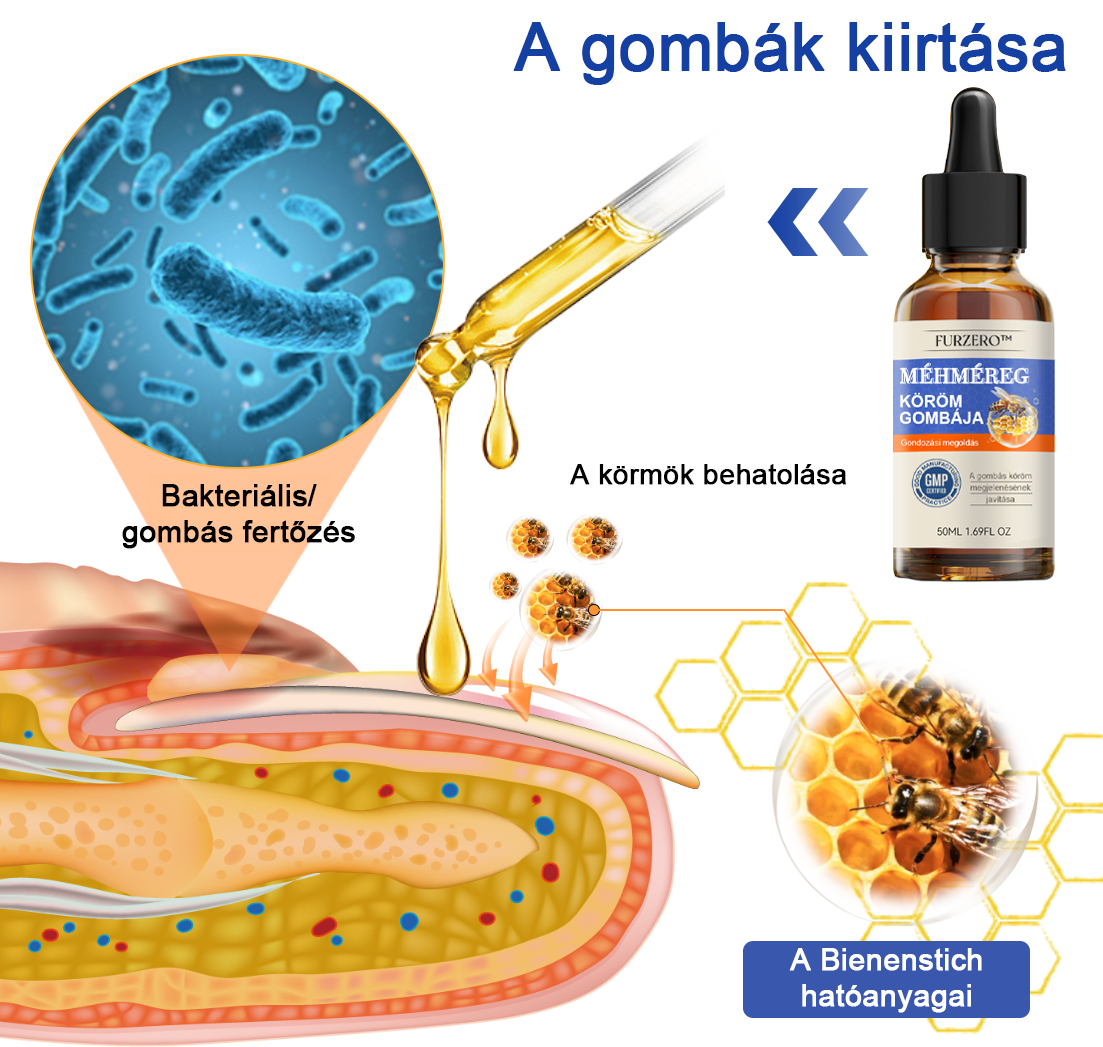 🐝Furzero™ Méhméreg Körömgomba Kezelőoldat: Teljes megoldás a körömgomba problémájára🌟